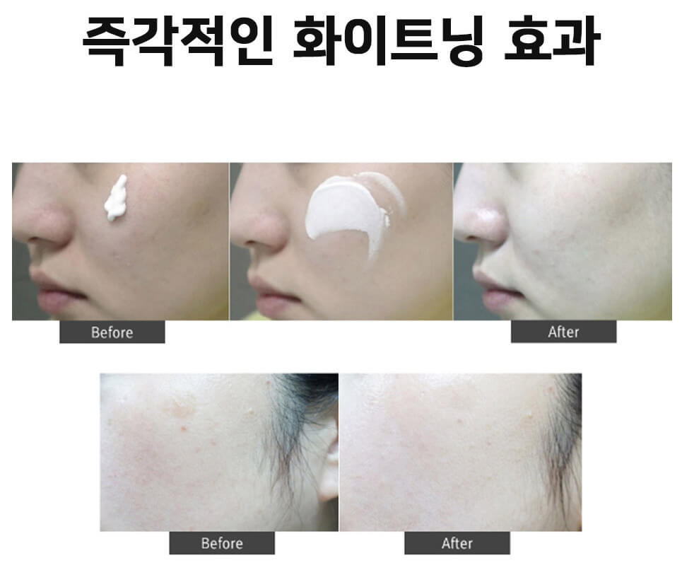 Trước và sau khi sử dụng kem Trước và sau khi sử dụng kem